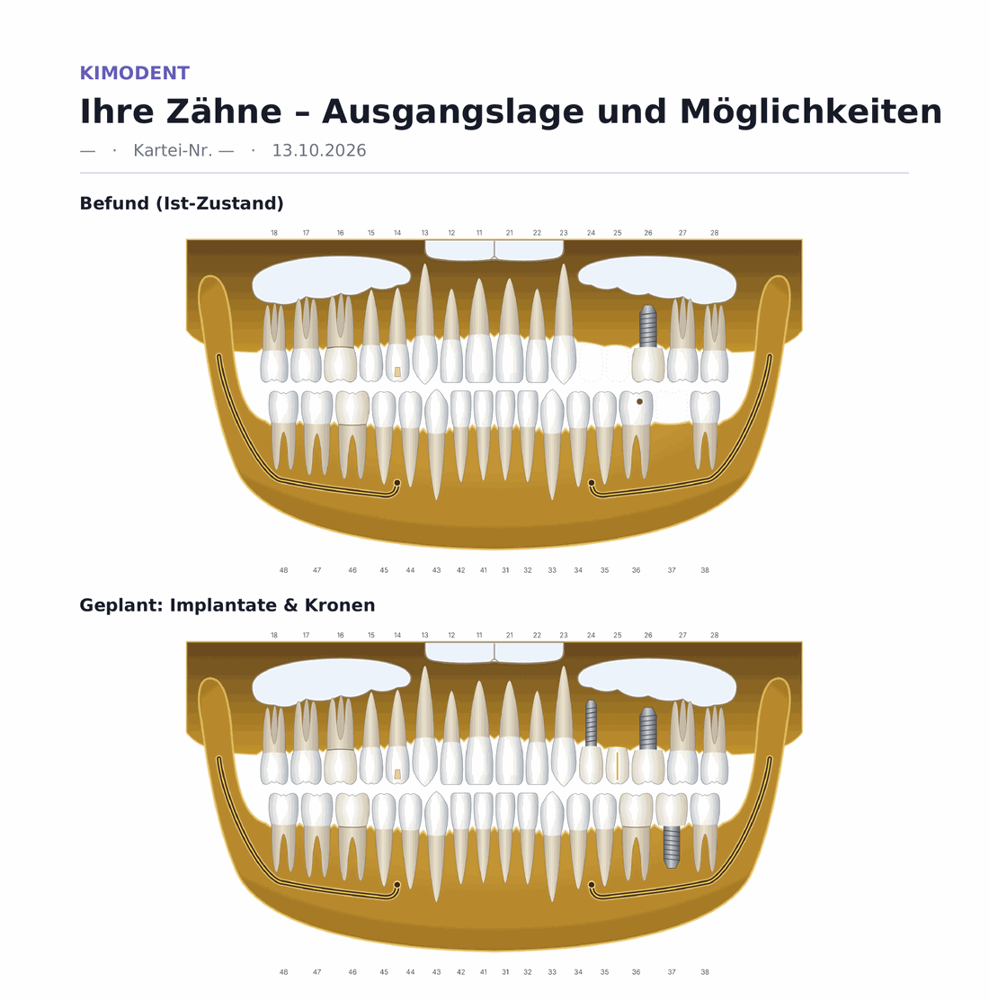 kimodent: PDF-Ausdruck mit Kopfzeile und zwei Panoramaansichten – Befund (Ist-Zustand) und Planung – auf weißem Hintergrund